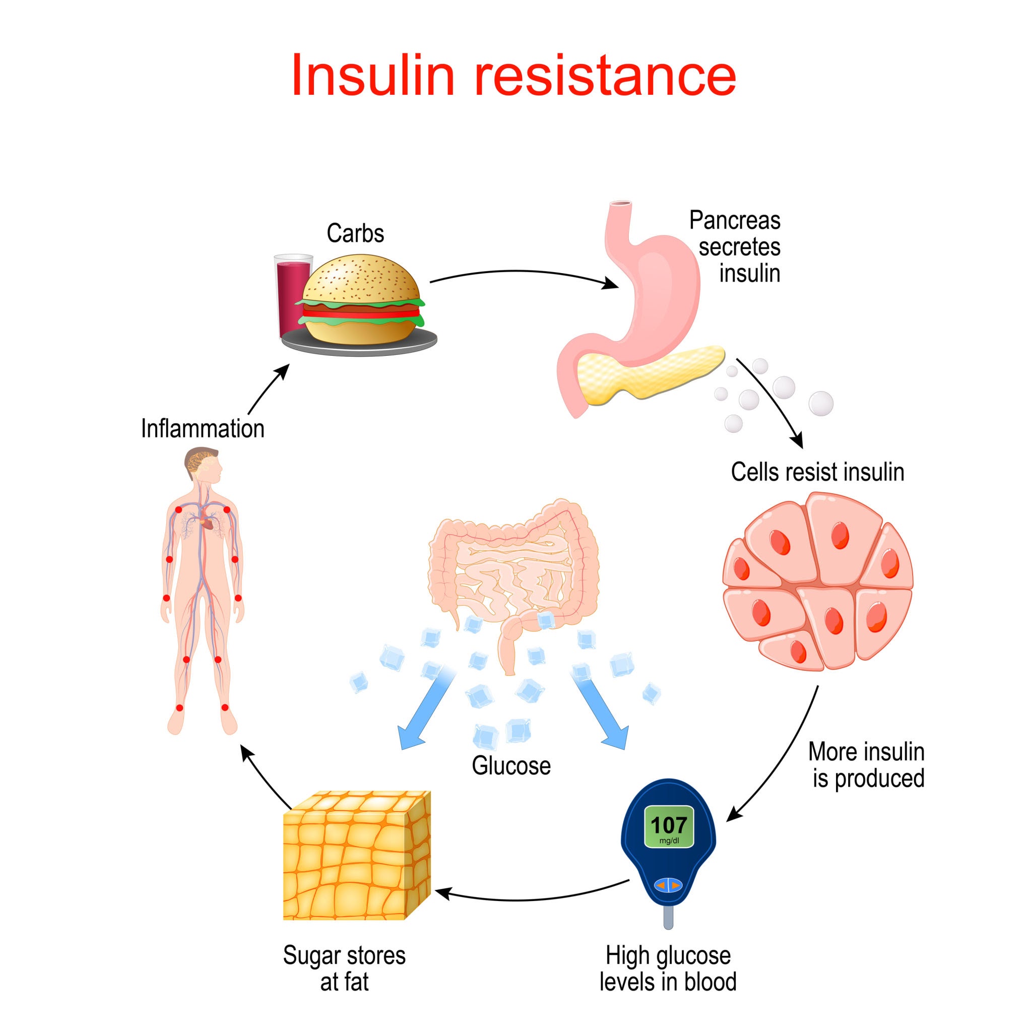 Understanding Insulin Resistance Mechanism in the Human Body