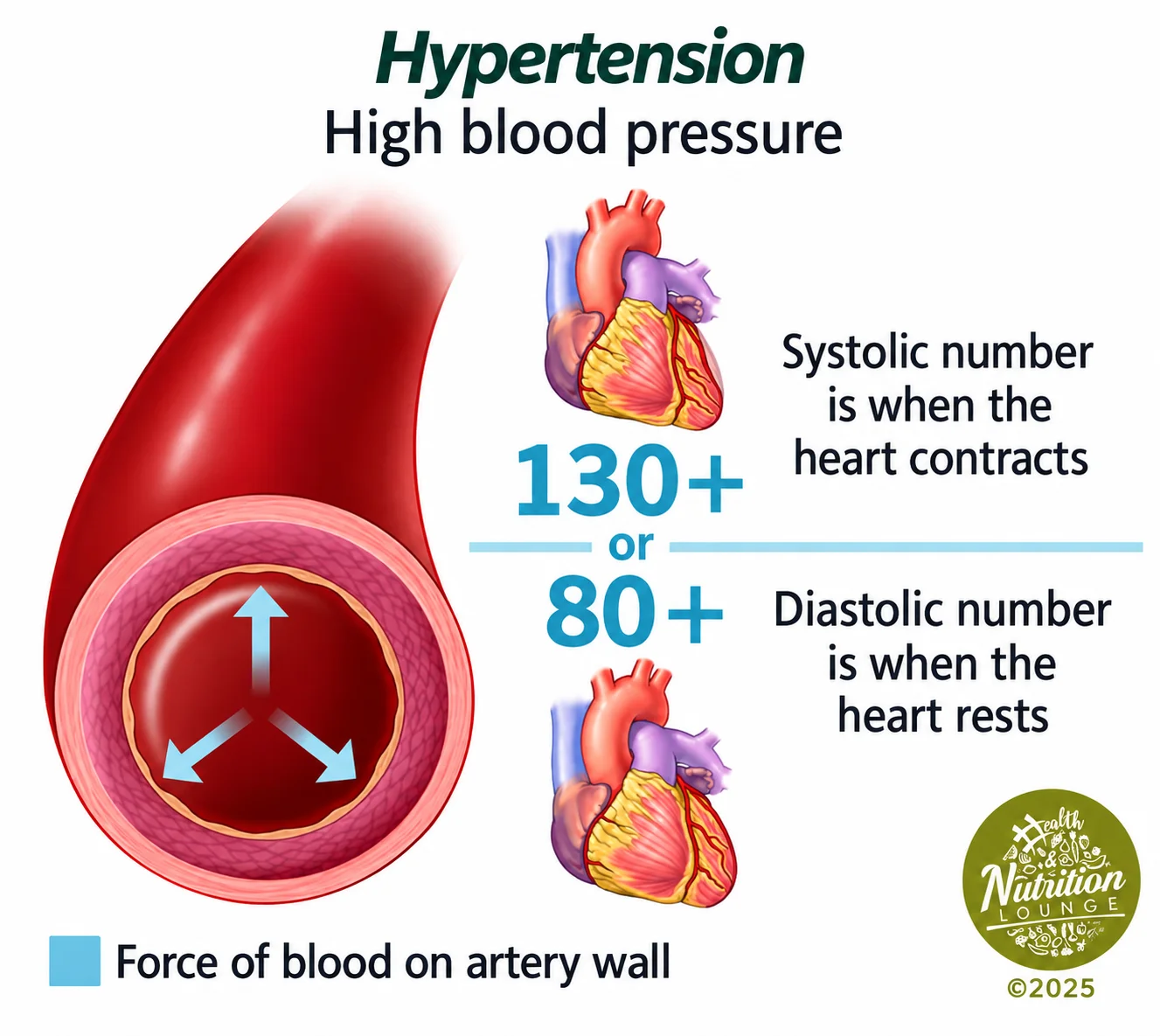 Illustration explaining hypertension and how high blood pressure affects the artery walls.